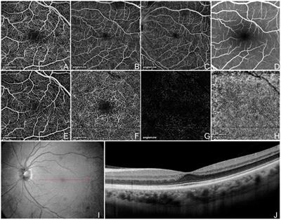 The Development and Clinical Application of Innovative Optical Ophthalmic Imaging Techniques